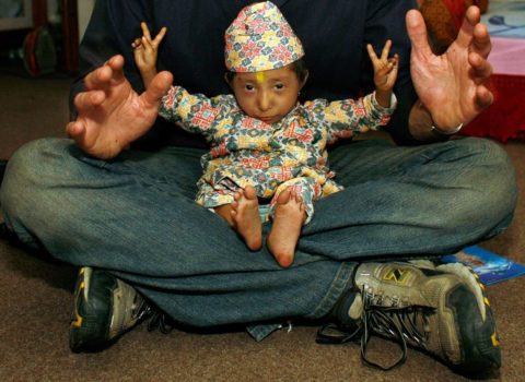 Dünyanın ən kiçik insanı vəfat etdi – FOTO