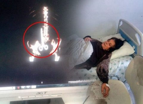 Xəstənin qarnında qayçı unudulması ilə bağlı açıqlama: “Həkim robot deyil ki!”