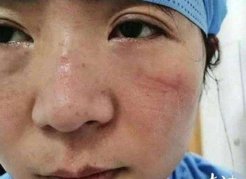 Koronavirus həkimləri bu vəziyyətə saldı – FOTOLAR