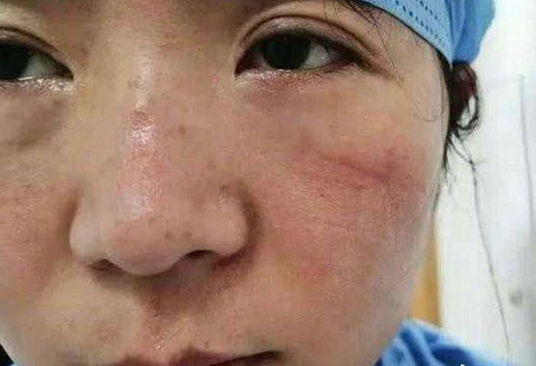 Koronavirus həkimləri bu vəziyyətə saldı – FOTOLAR Koronavirus həkimləri bu vəziyyətə saldı – FOTOLAR