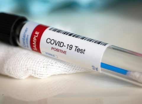 Azərbaycanda vəzifəli şəxsdə koronavirus aşkarlandı