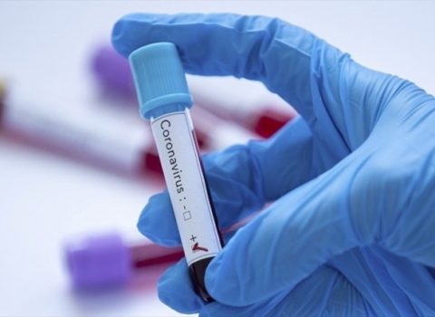 İrandan qayıdan üç azərbaycanlıda koronavirus aşkarlandı