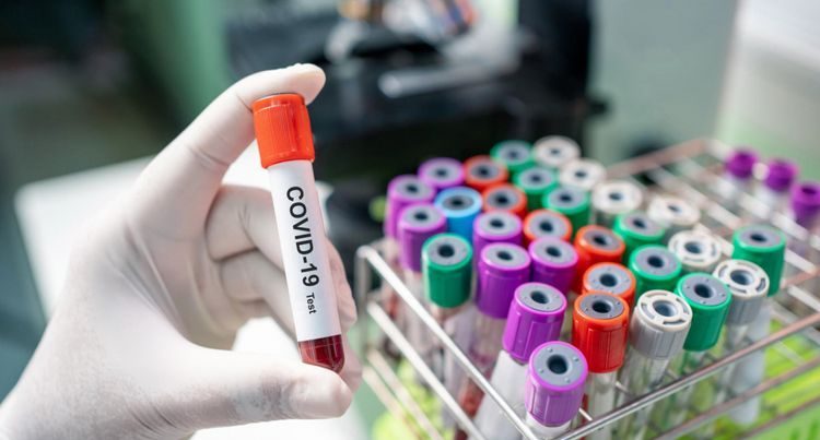 Azərbaycanda koronavirus STATİSTİKASI Azərbaycanda koronavirus STATİSTİKASI