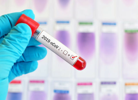 Qarabağdakı qondarma “seçkilərdə” koronavirus daşıyıcısı səs verdi