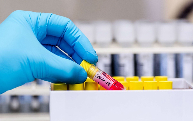 Azərbaycanda daha 65 nəfərdə koronavirus aşkarlandı – 58 nəfər sağaldı Azərbaycanda daha 65 nəfərdə koronavirus aşkarlandı – 58 nəfər sağaldı