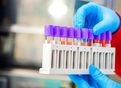 Koronavirus pandemiyasının başa çatacağı VAXT AÇIQLANDI