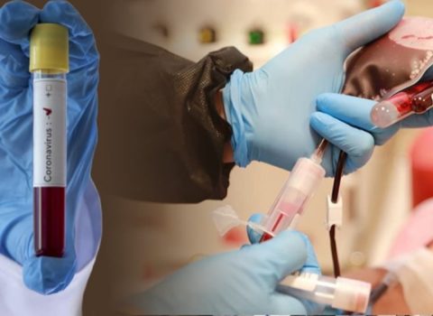Azərbaycanda klinikalar koronavirus testi müayinələrini DAYANDIRDI – SƏBƏB