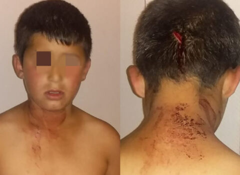 Bakıda atanın 11 yaşlı oğlunu bıçaqlaması ilə bağlı araşdırma başlanıldı – RƏSMİ