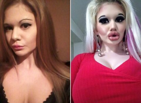 Özünü “Barbi”yə bənzətmək istədi, bu vəziyyətə düşdü – FOTO