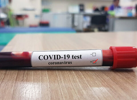 Dünya tibbində ŞOK – COVID-19-a “həmişəlik” yoluxma faktı QEYDƏ ALINDI