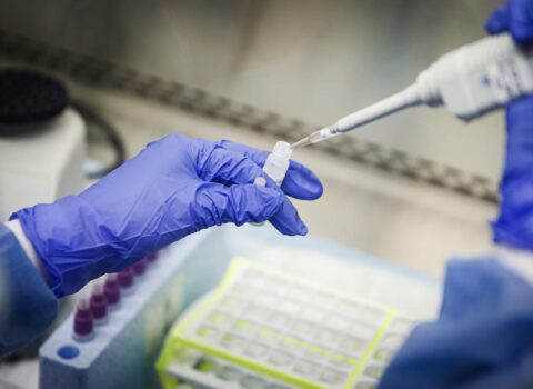 ÜST rəsmisindən koronavirus testləri ilə bağlı — MÜHÜM AÇIQLAMA