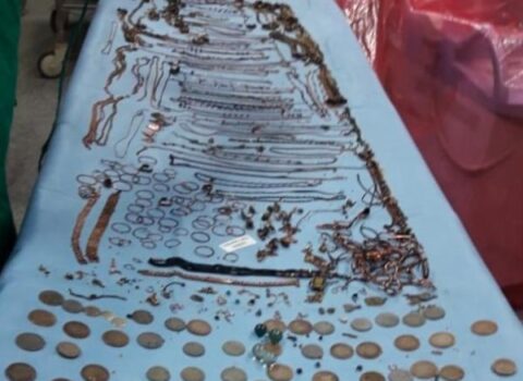 Gənc qadının mədəsindən 2 kilo qızıl sikkə çıxarıldı