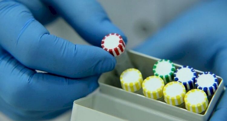 Koronavirus ən çox bu ölkədən gətirilən Azərbaycan vətəndaşlarında aşkarlanır Koronavirus ən çox bu ölkədən gətirilən Azərbaycan vətəndaşlarında aşkarlanır