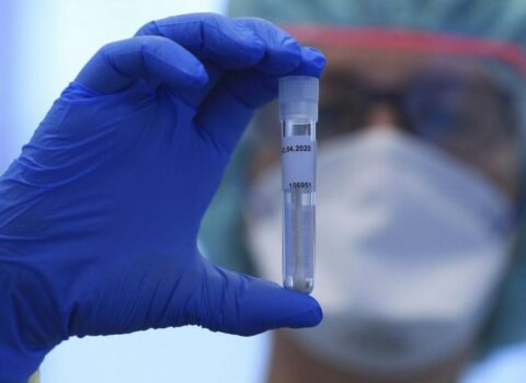 Azərbaycanda daha 329 nəfərdə koronavirus aşkarlandı – 7 nəfər öldü