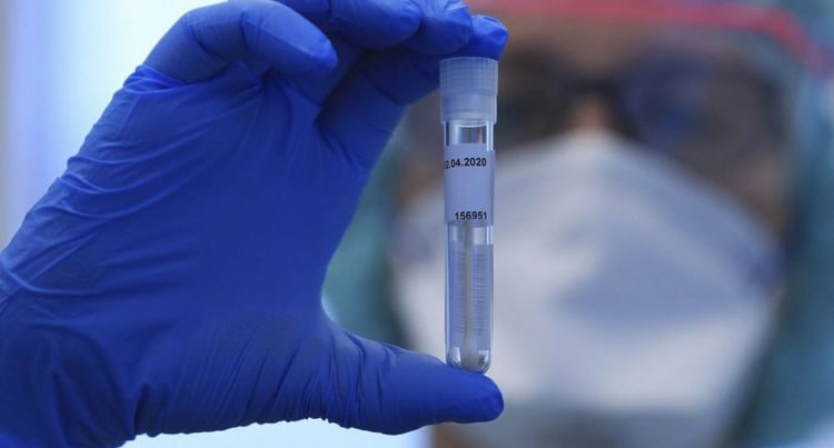 Azərbaycanda daha 329 nəfərdə koronavirus aşkarlandı – 7 nəfər öldü Azərbaycanda daha 329 nəfərdə koronavirus aşkarlandı – 7 nəfər öldü