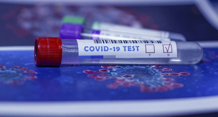 Koronavirus testlərinin qiyməti açıqlandı: TƏBİB Koronavirus testlərinin qiyməti açıqlandı: TƏBİB