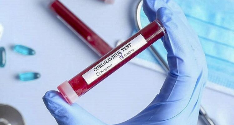 Qızdırması 37 olanlar koronavirus testindən keçməlidirmi? – AÇIQLAMA Qızdırması 37 olanlar koronavirus testindən keçməlidirmi? – AÇIQLAMA