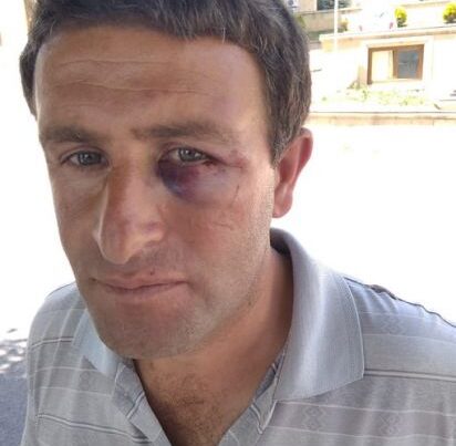 Daşkəsəndə məmur vətəndaşı döydü – VİDEO Daşkəsəndə məmur vətəndaşı döydü – VİDEO