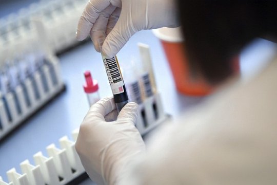 Koronavirusun gizli simptomları MƏLUM OLDU Koronavirusun gizli simptomları MƏLUM OLDU