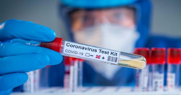 Azərbaycanda koronavirusla bağlı testlərin sayı 380 mini ötdü Azərbaycanda koronavirusla bağlı testlərin sayı 380 mini ötdü