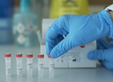 Azərbaycanda koronavirusla bağlı testlərin sayı açıqlanıb – RƏSMİ