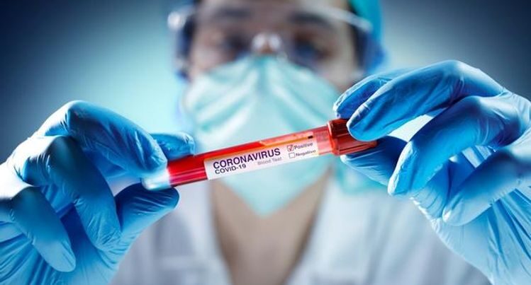 Azərbaycanlı iş adamı və anası koronavirusdan öldü Azərbaycanlı iş adamı və anası koronavirusdan öldü