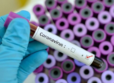 AZƏRBAYCANDA indiyədək 516533 koronavirus testi aparıldı