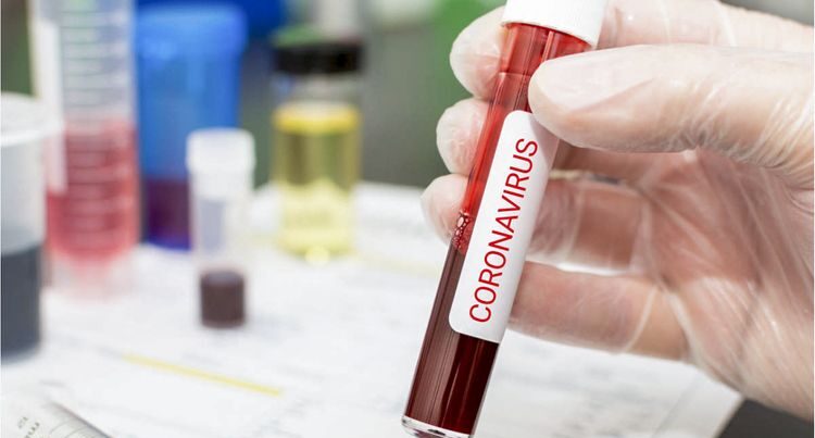 Azərbaycanda indiyədək 560356 koronavirus testi aparıldı Azərbaycanda indiyədək 560356 koronavirus testi aparıldı