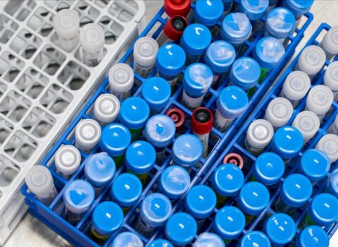 ÜST bu preparatın kliniki testlərini dayandırdı