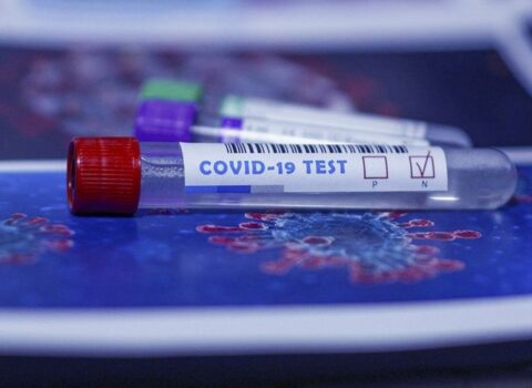 Azərbaycanda ümumilikdə 910 890 koronavirus testi aparıldı