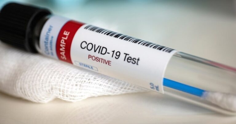 Reanimasiyada olan COVID-19 xəstələrinin sayı açıqlandı Reanimasiyada olan COVID-19 xəstələrinin sayı açıqlandı