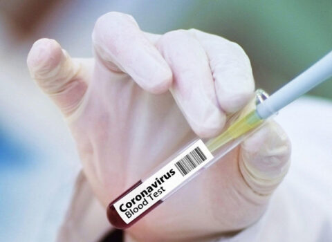 Antarktidada da koronavirus aşkarlandı
