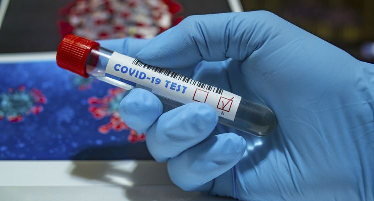 Azərbaycanda indiyədək 1095543 koronavirus testi aparıldı Azərbaycanda indiyədək 1095543 koronavirus testi aparıldı
