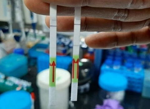 Dünyanın ilk kağız koronavirus testi hazırlanır