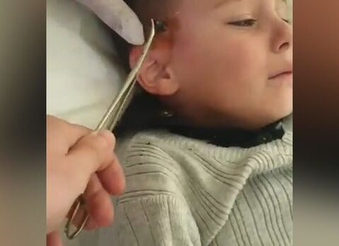 Azyaşlının başından qəlpə çıxarıldı – Sərhəd tanımayan erməni vəhşiliyi… – VİDEO