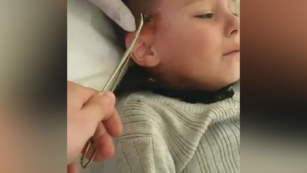 Azyaşlının başından qəlpə çıxarıldı – Sərhəd tanımayan erməni vəhşiliyi… – VİDEO Azyaşlının başından qəlpə çıxarıldı – Sərhəd tanımayan erməni vəhşiliyi… – VİDEO
