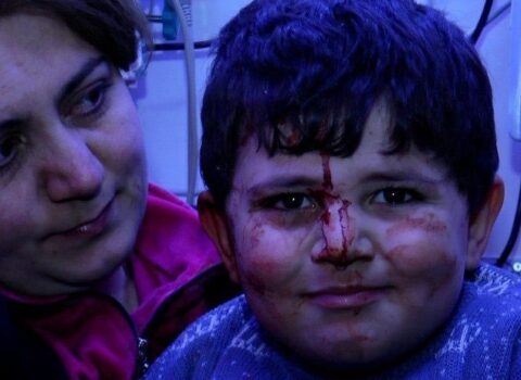 Ermənistanın Gəncədə törətdiyi növbəti terrordan bir il ötür – VİDEO