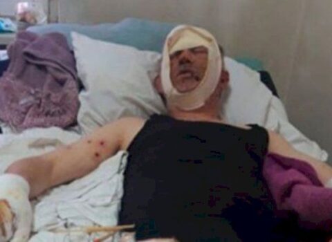 Erməni polkovnik Naftalanda müalicə olunur – FOTO