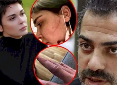 “Məni döyüb, yarıçılpaq videomu çəkdi” – FOTO