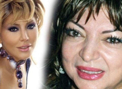 Lalə Dadaşova tanınmaz halda – Ağır xəstəliyə yoluxub? – FOTO