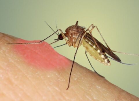 Ağcaqanad sancmasından əziyyət çəkənlər MÜTLƏQ OXUSUNLAR