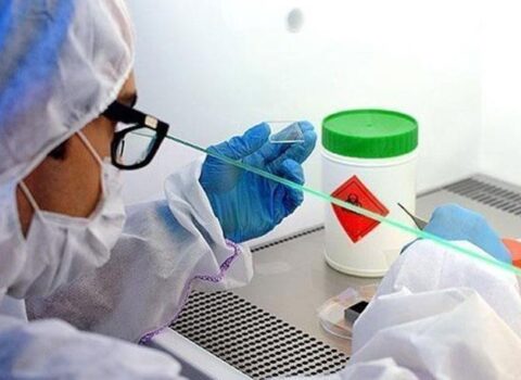 On minlərlə insanın ölümünə səbəb olan virusa qarşı Azərbaycan vaksin hazırladı