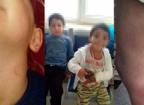 Bakıda valideynlərin uşaqlarına verdiyi DƏHŞƏTLİ İŞGƏNCƏ ÜSULLARI : Ayaqdan asdılar və…