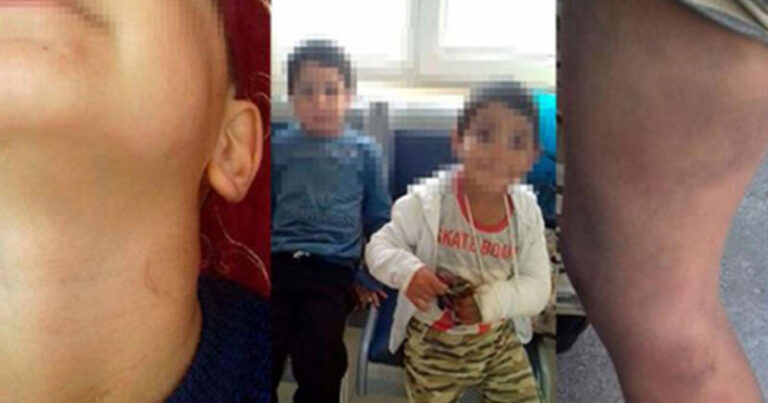 Bakıda valideynlərin uşaqlarına verdiyi DƏHŞƏTLİ İŞGƏNCƏ ÜSULLARI : Ayaqdan asdılar və… Bakıda valideynlərin uşaqlarına verdiyi DƏHŞƏTLİ İŞGƏNCƏ ÜSULLARI : Ayaqdan asdılar və…
