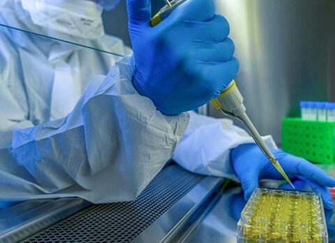 Alimlər ilk dəfə koronavirusdan ölən insanın ağ ciyərini görüntülədilər – FOTO