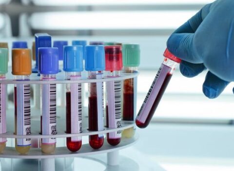Dünyada koronavirusla bağlı SON STATİSTİKA