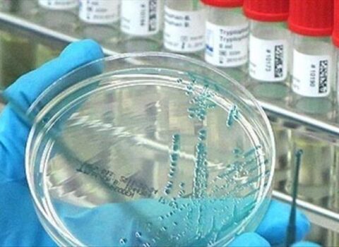Yeni virus ortaya çıxdı – “LASSA”