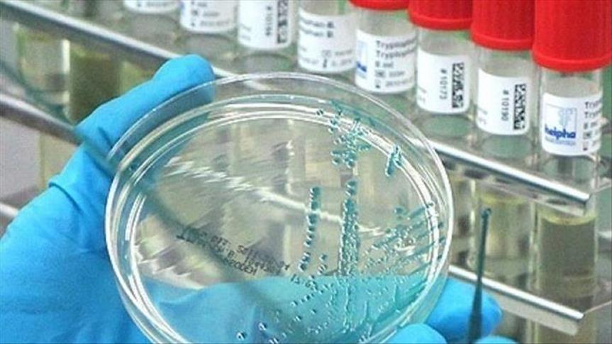 Yeni virus ortaya çıxdı - 