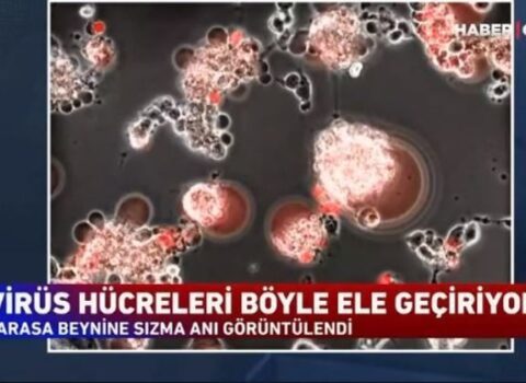 Koronavirus hüceyrələrə belə daxil olur – ANBAAN VİDEO