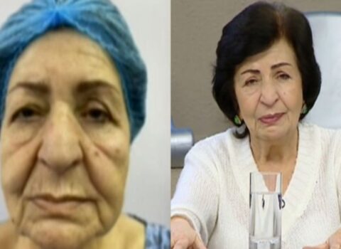 “Plastik əməliyyatla 15 yaş cavanlaşdım” – Kübra Əliyeva